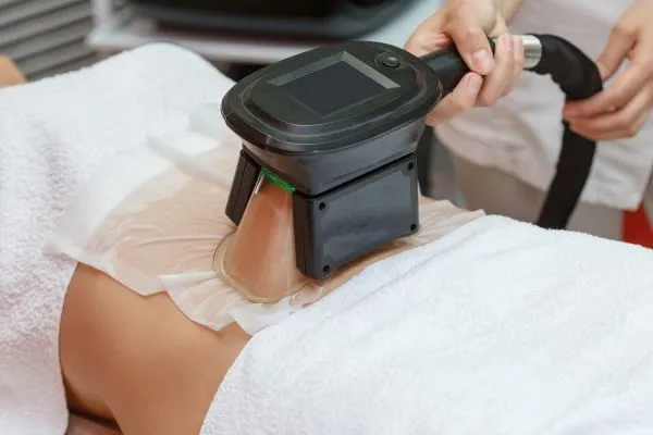 Image of person having fat freezing treatment to help weight gain Blackburn