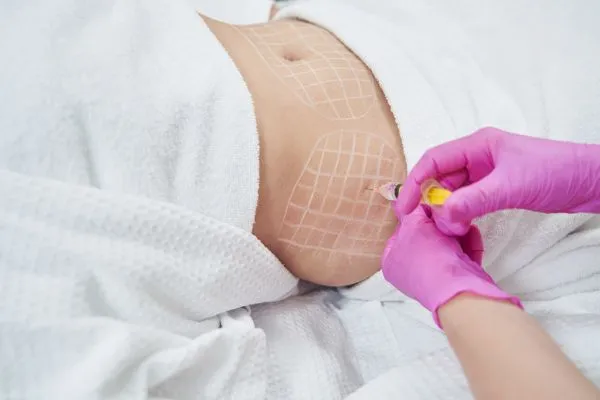 image of fat dissolving injections on love handles to help combat weight gain Blackburn