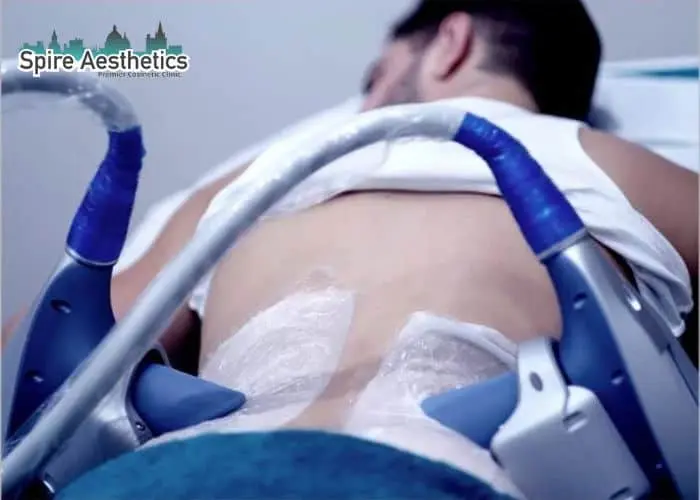 Man having fat freezing treatment done on love handles before a competitions Blackburn to create a sculpted look.
