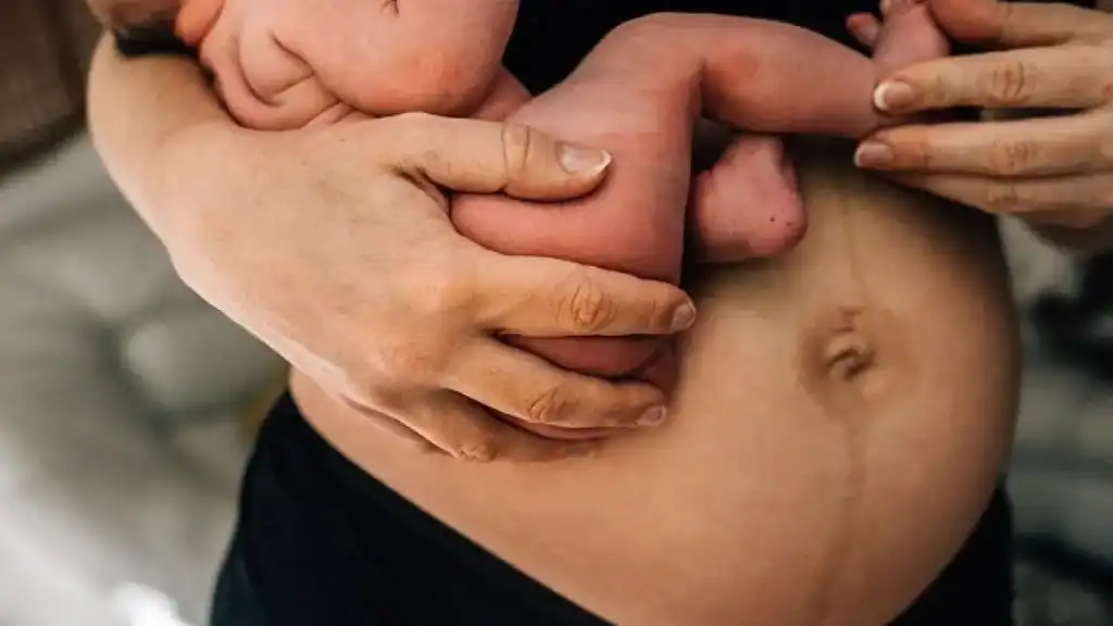 Why Is My Stomach Still Big After Pregnancy Blackburn?